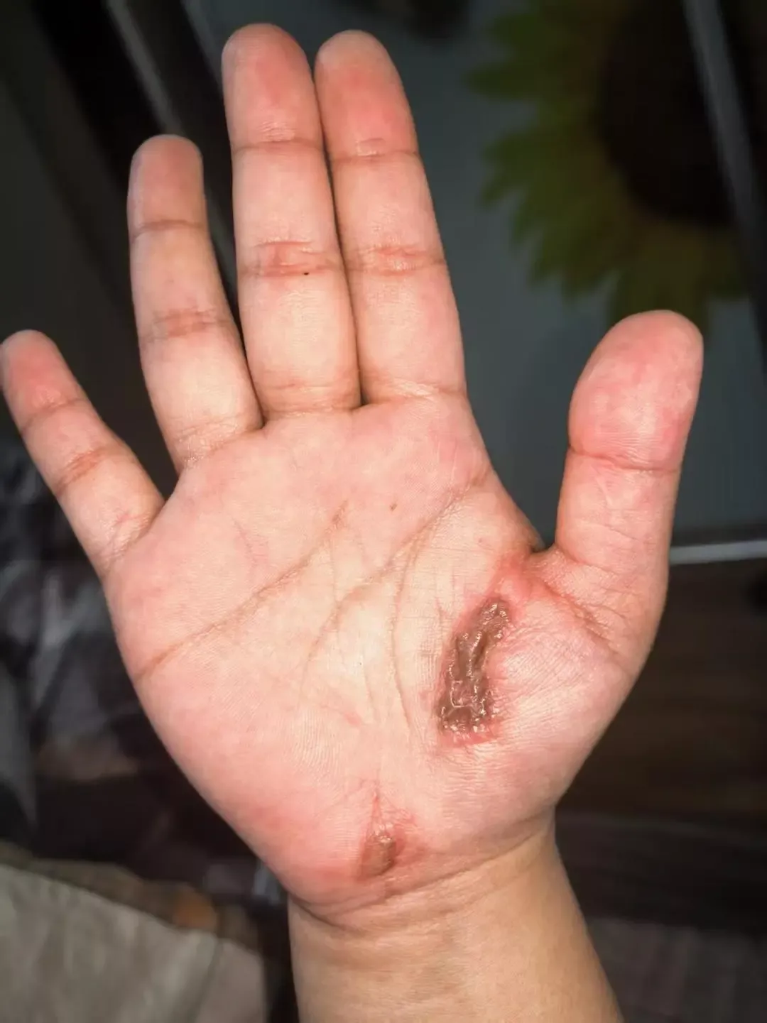 女子称边充电边玩手机遭电击,电流瞬间击穿全身